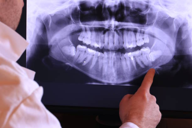 Best Emergency Dental Care for Broken or Chipped Teeth in Mcelhattan, PA